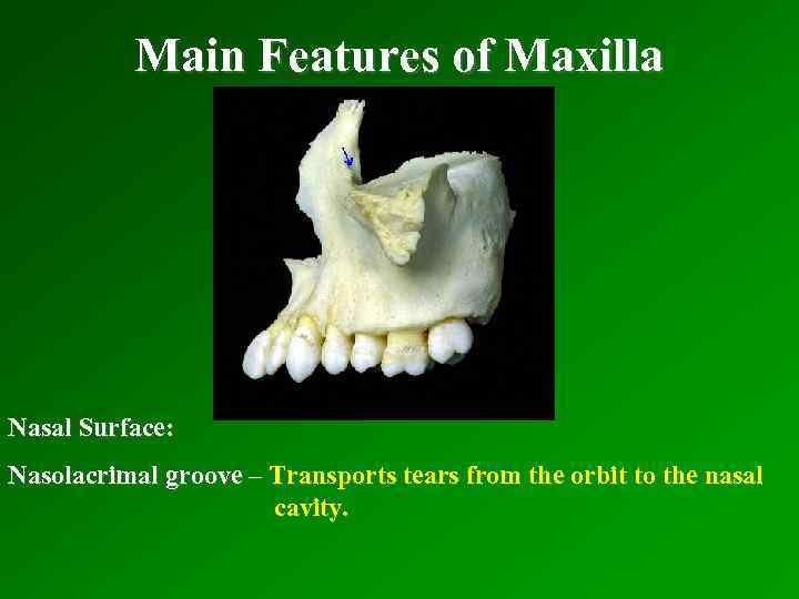 Main Features of Maxilla Nasal Surface: Nasolacrimal groove – Transports tears from the orbit