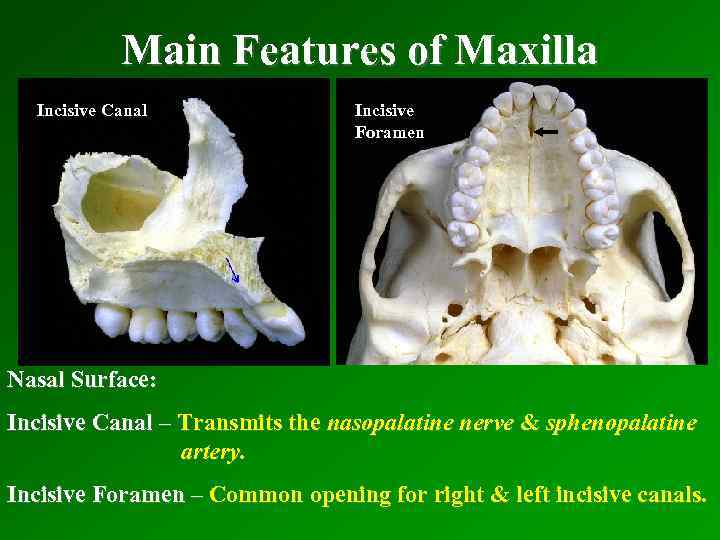 Main Features of Maxilla Incisive Canal Incisive Foramen Nasal Surface: Incisive Canal – Transmits