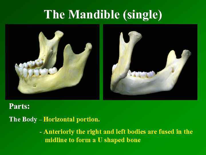 The Mandible (single) Parts: The Body – Horizontal portion. - Anteriorly the right and