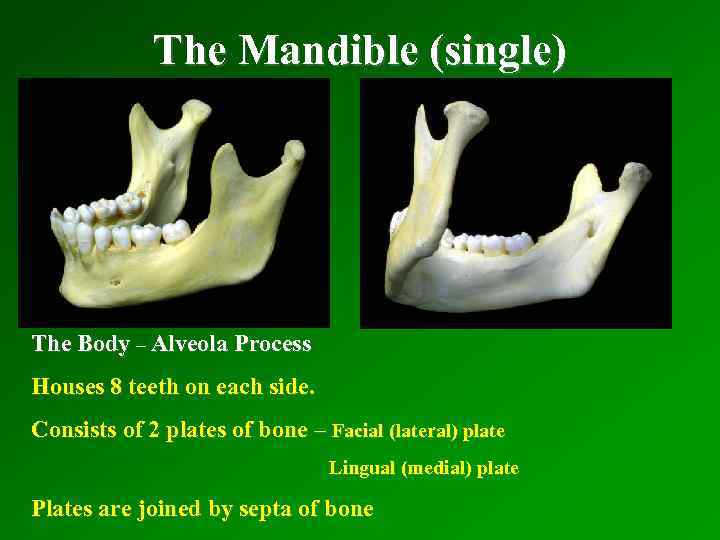 The Mandible (single) The Body – Alveola Process Houses 8 teeth on each side.