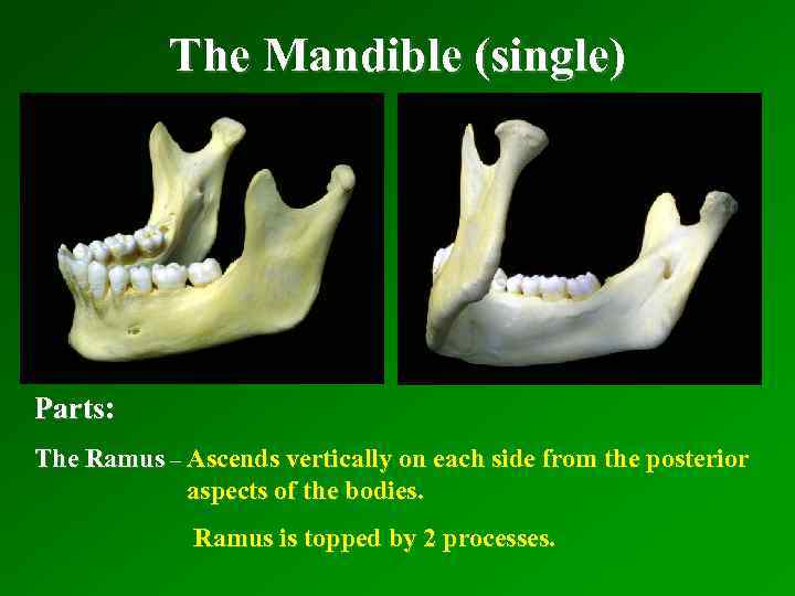 The Mandible (single) Parts: The Ramus – Ascends vertically on each side from the