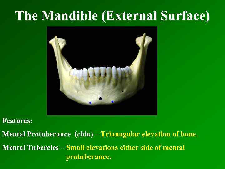 The Mandible (External Surface) Features: Mental Protuberance (chin) – Trianagular elevation of bone. Mental