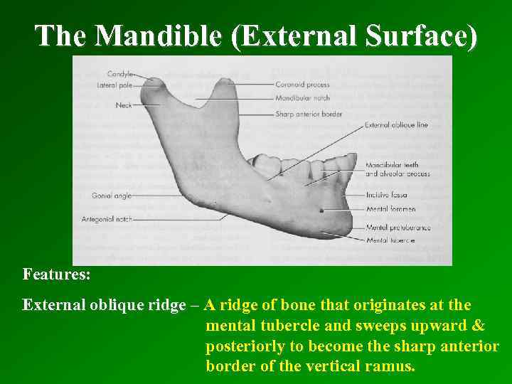 The Mandible (External Surface) Features: External oblique ridge – A ridge of bone that