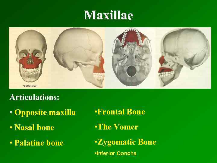 Maxillae Articulations: • Opposite maxilla • Frontal Bone • Nasal bone • The Vomer