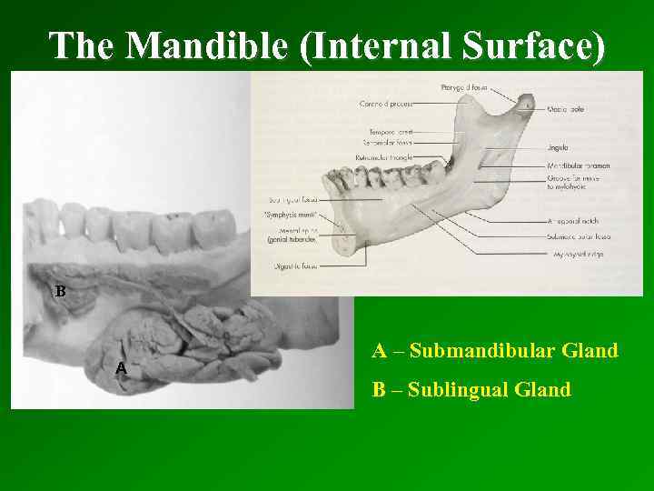 The Mandible (Internal Surface) B A A – Submandibular Gland B – Sublingual Gland