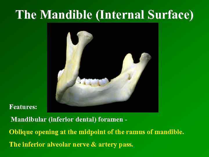 The Mandible (Internal Surface) Features: Mandibular (inferior dental) foramen Oblique opening at the midpoint