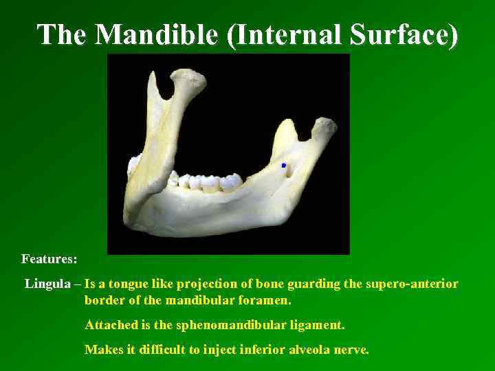 The Mandible (Internal Surface) Features: Lingula – Is a tongue like projection of bone