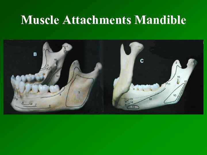 Muscle Attachments Mandible 