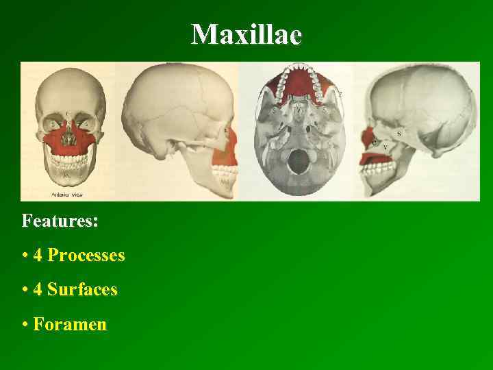 Maxillae Features: • 4 Processes • 4 Surfaces • Foramen 