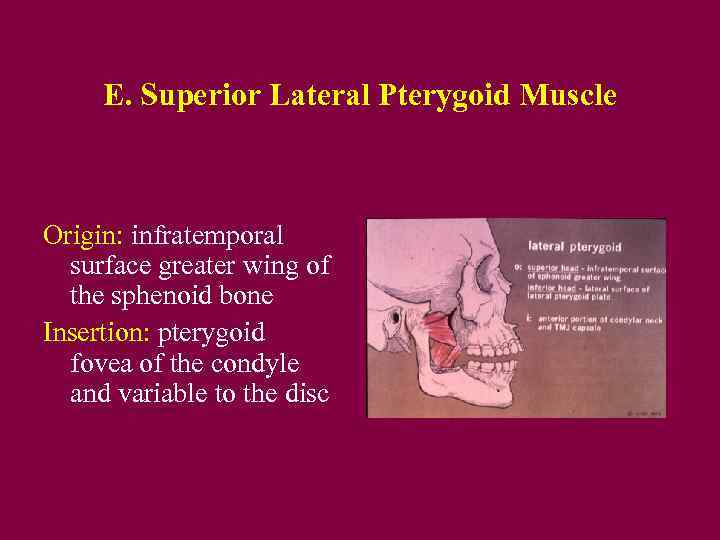 E. Superior Lateral Pterygoid Muscle Origin: infratemporal surface greater wing of the sphenoid bone