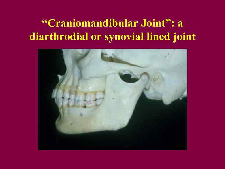 “Craniomandibular Joint”: a diarthrodial or synovial lined joint 