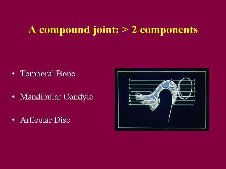 A compound joint: > 2 components • Temporal Bone • Mandibular Condyle • Articular