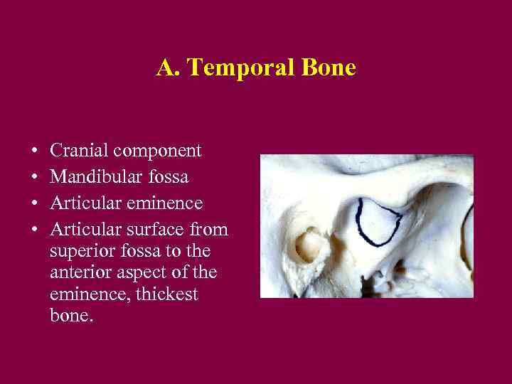 A. Temporal Bone • • Cranial component Mandibular fossa Articular eminence Articular surface from