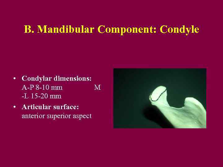 B. Mandibular Component: Condyle • Condylar dimensions: A-P 8 -10 mm M -L 15