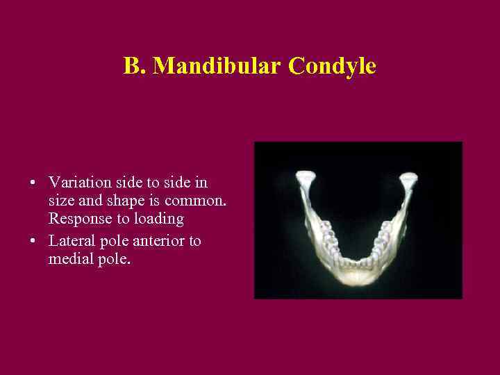 B. Mandibular Condyle • Variation side to side in size and shape is common.