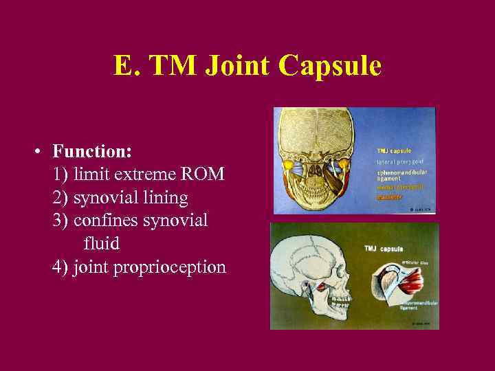 E. TM Joint Capsule • Function: 1) limit extreme ROM 2) synovial lining 3)