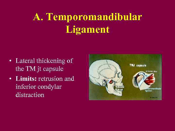 A. Temporomandibular Ligament • Lateral thickening of the TM jt capsule • Limits: retrusion