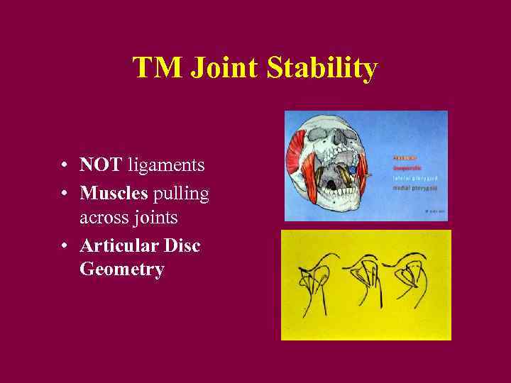 TM Joint Stability • NOT ligaments • Muscles pulling across joints • Articular Disc