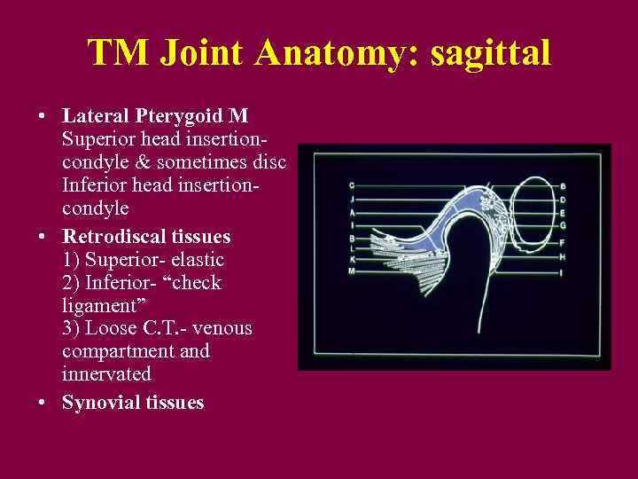 TM Joint Anatomy: sagittal • Lateral Pterygoid M Superior head insertioncondyle & sometimes disc