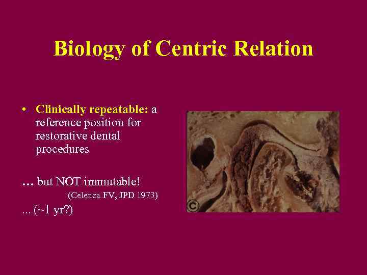 Biology of Centric Relation • Clinically repeatable: a reference position for restorative dental procedures