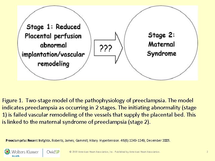 Figure 1. Two-stage model of the pathophysiology of preeclampsia. The model indicates preeclampsia as