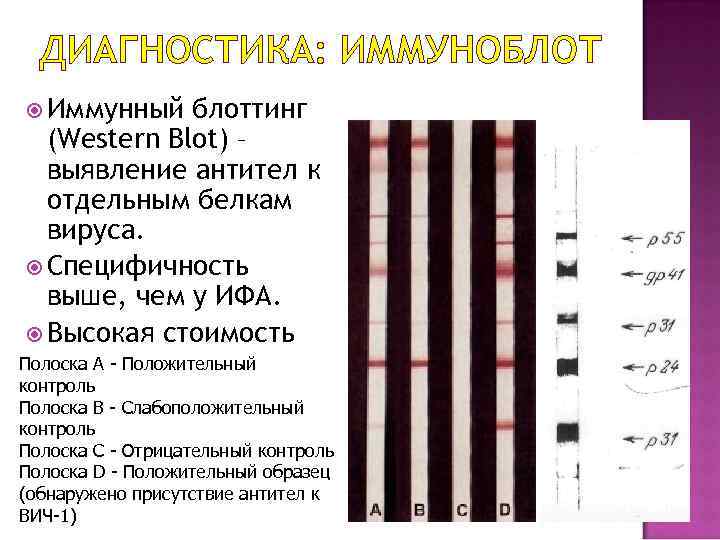 Igg иммуноблот. ИФА И иммуноблот. Положительный иммуноблот.