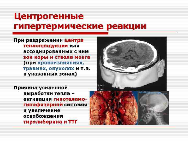 Центрогенные гипертермические реакции При раздражении центра теплопродукции или ассоциированных с ним зон коры и