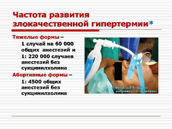 Частота развития злокачественной гипертермии* Тяжелые формы – 1 случай на 60 000 общих анестезий