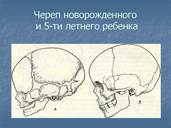 Череп новорожденного и 5 -ти летнего ребенка 