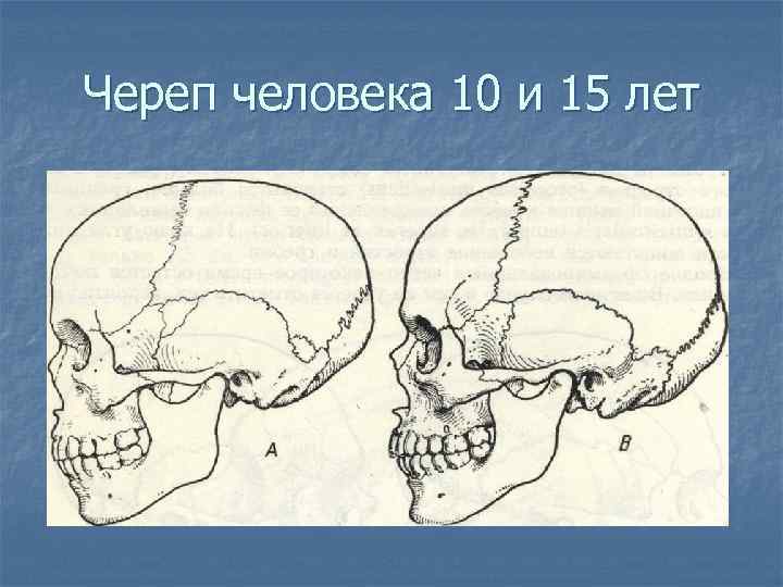 Череп человека 10 и 15 лет 