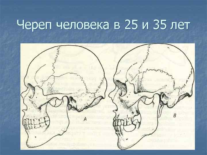 Череп человека в 25 и 35 лет 