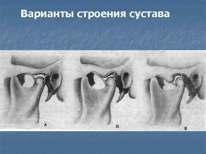 Варианты строения сустава 