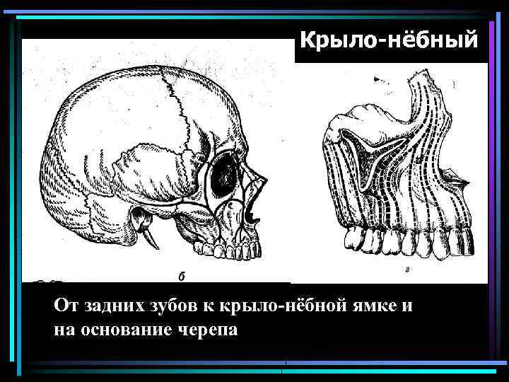 Крыло-нёбный От задних зубов к крыло-нёбной ямке и на основание черепа 