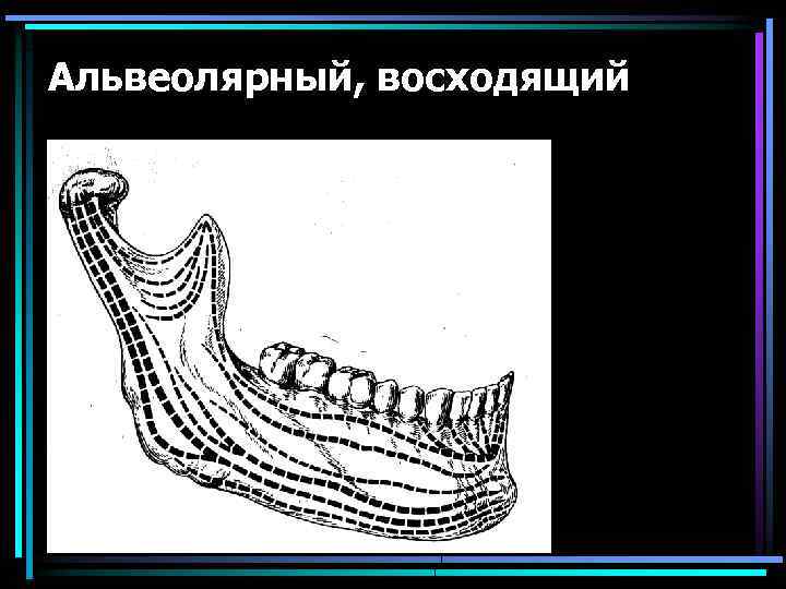 Альвеолярный, восходящий 