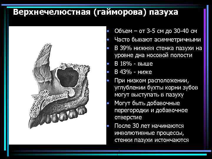 Верхнечелюстная (гайморова) пазуха • Объем – от 3 -5 см до 30 -40 см