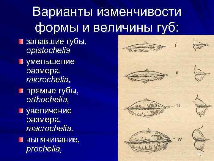 Варианты изменчивости формы и величины губ: запавшие губы, opistochelia уменьшение размера, microchelia, прямые губы,