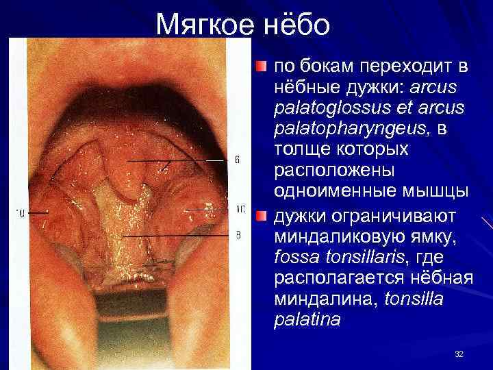 Мягкое нёбо по бокам переходит в нёбные дужки: arcus palatoglossus et arcus palatopharyngeus, в