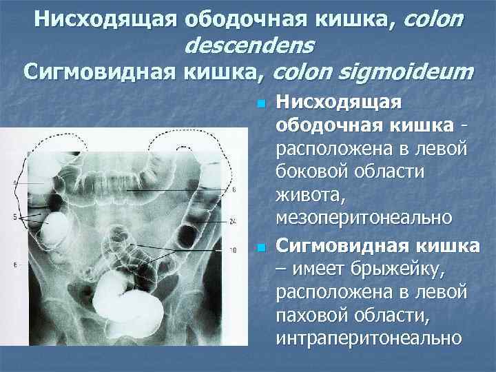 Сигмовидная кишка где находится схема у женщин боль