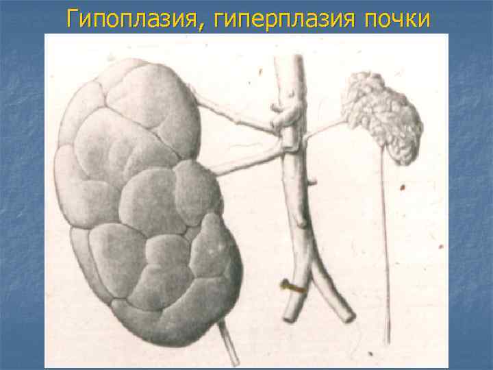 Патология в рисунках