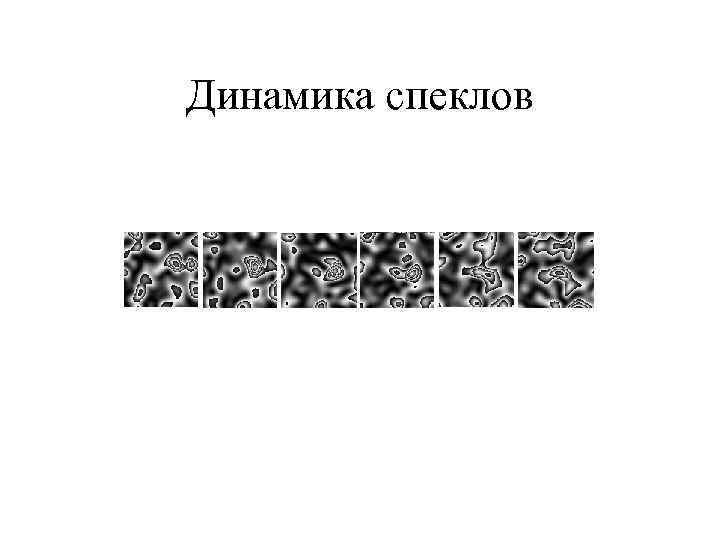 Динамика спеклов 