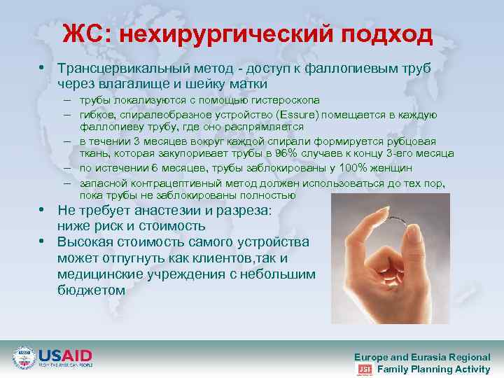 ЖС: нехирургический подход • Трансцервикальный метод - доступ к фаллопиевым труб через влагалище и