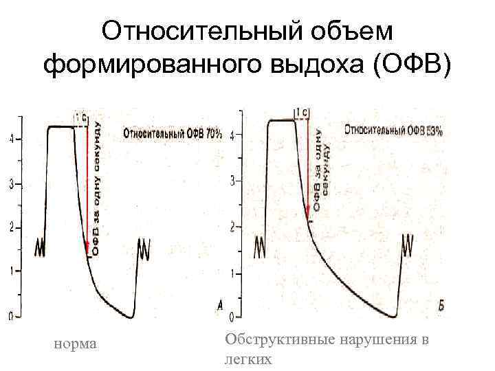 Относительный объем формированного выдоха (ОФВ) норма Обструктивные нарушения в легких 