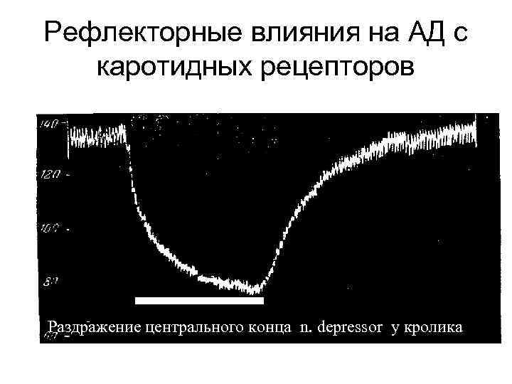 Рефлекторные влияния на АД с каротидных рецепторов Раздражение центрального конца n. depressor у кролика