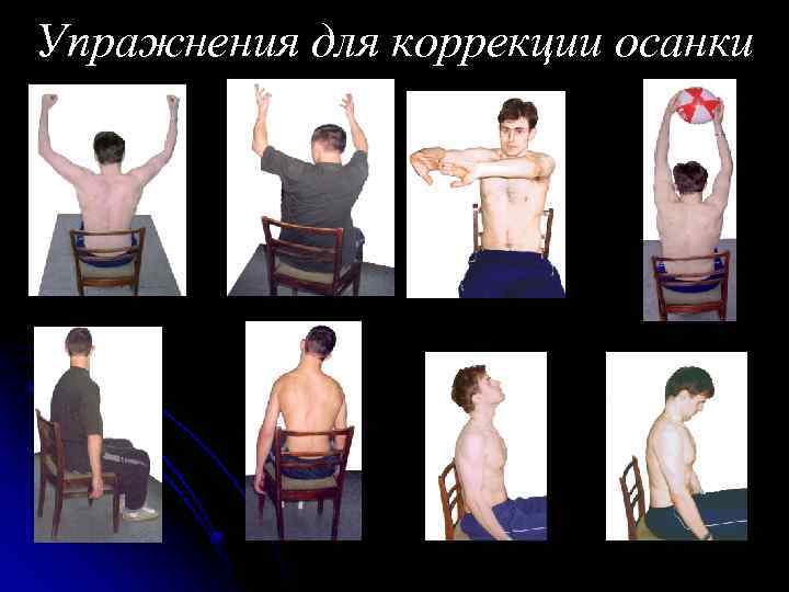 Упражнения для коррекции осанки 