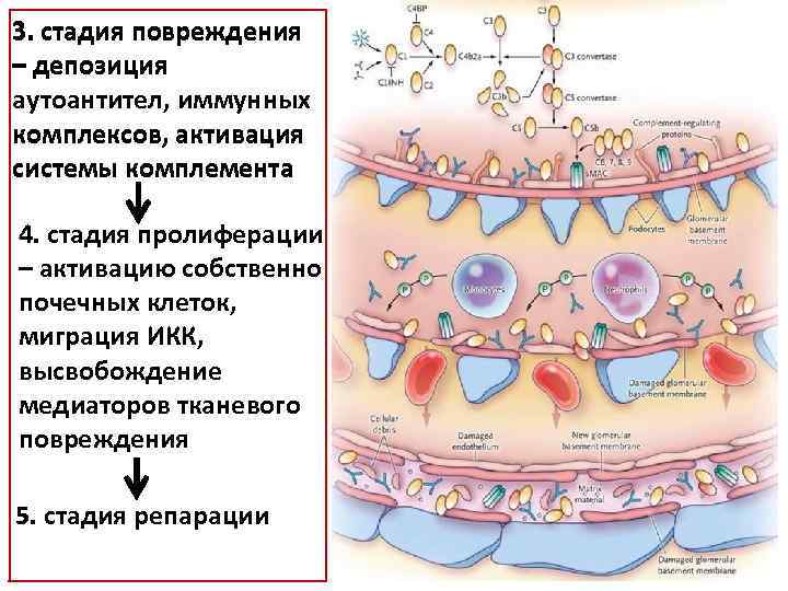 3. стадия повреждения – депозиция аутоантител, иммунных комплексов, активация системы комплемента 4. стадия пролиферации