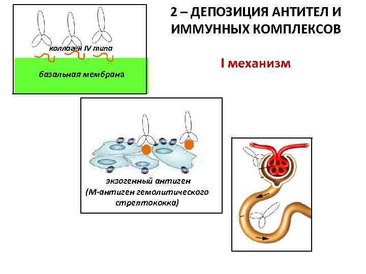 2 – ДЕПОЗИЦИЯ АНТИТЕЛ И ИММУННЫХ КОМПЛЕКСОВ коллаген IV типа базальная мембрана экзогенный антиген