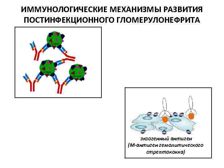 ИММУНОЛОГИЧЕСКИЕ МЕХАНИЗМЫ РАЗВИТИЯ ПОСТИНФЕКЦИОННОГО ГЛОМЕРУЛОНЕФРИТА экзогенный антиген (М-антиген гемолитического стрептококка) 