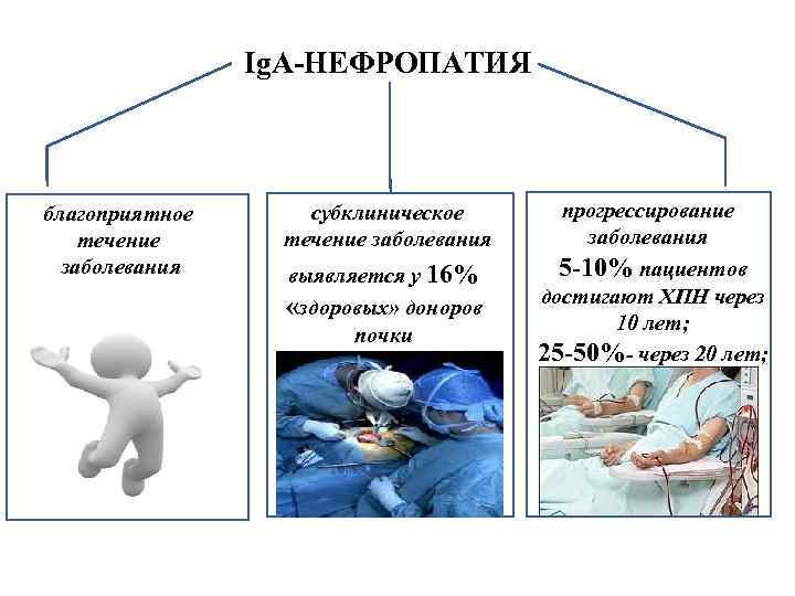 Ig. A-НЕФРОПАТИЯ благоприятное течение заболевания субклиническое течение заболевания выявляется у 16% «здоровых» доноров почки