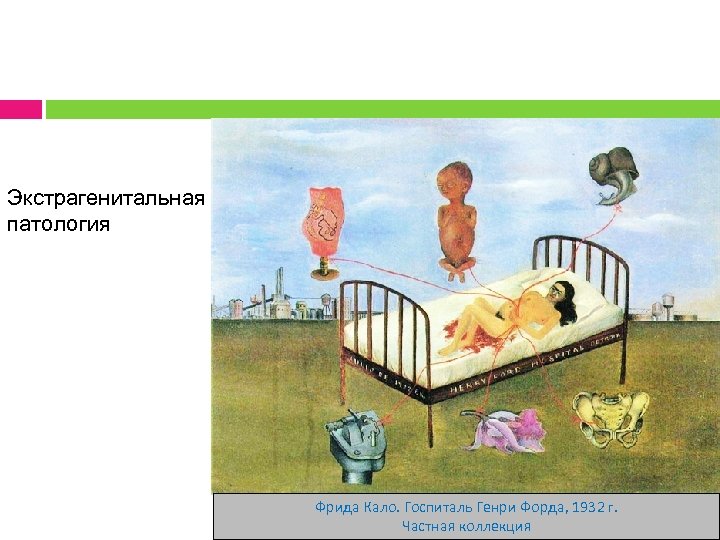 Экстрагенитальная патология Фрида Кало. Госпиталь Генри Форда, 1932 г. Частная коллекция 