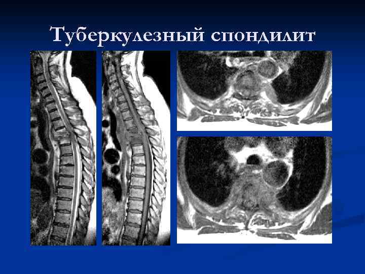 Планарное изображение лучевая диагностика